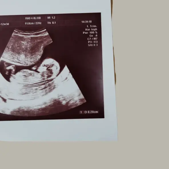 pro-life