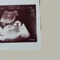 pro-life