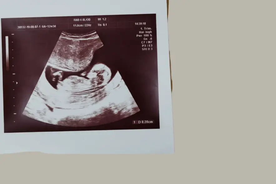 pro-life