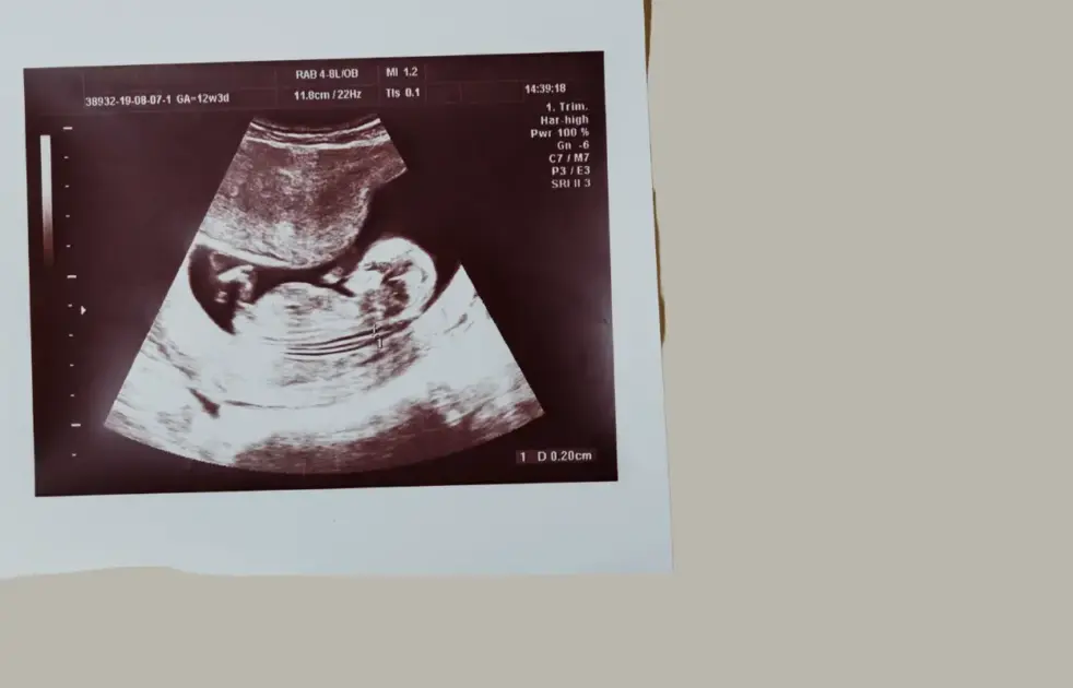 pro-life