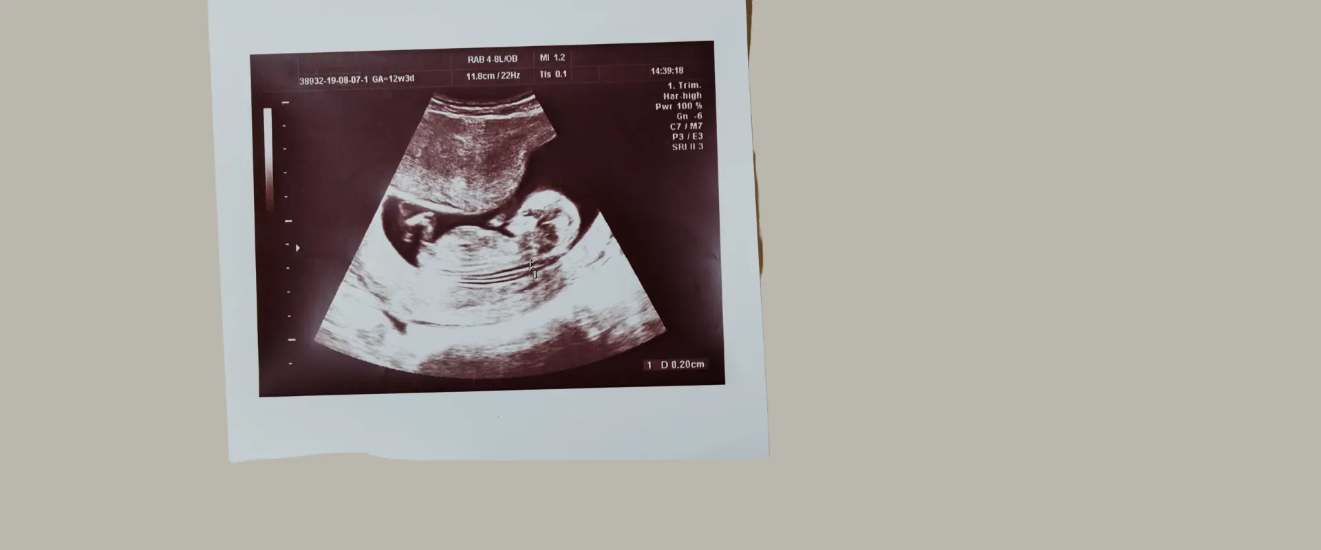 pro-life